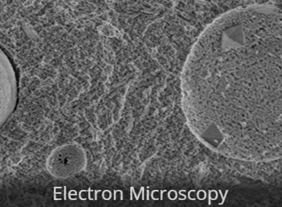 Picture of IALS Electron Microscopy